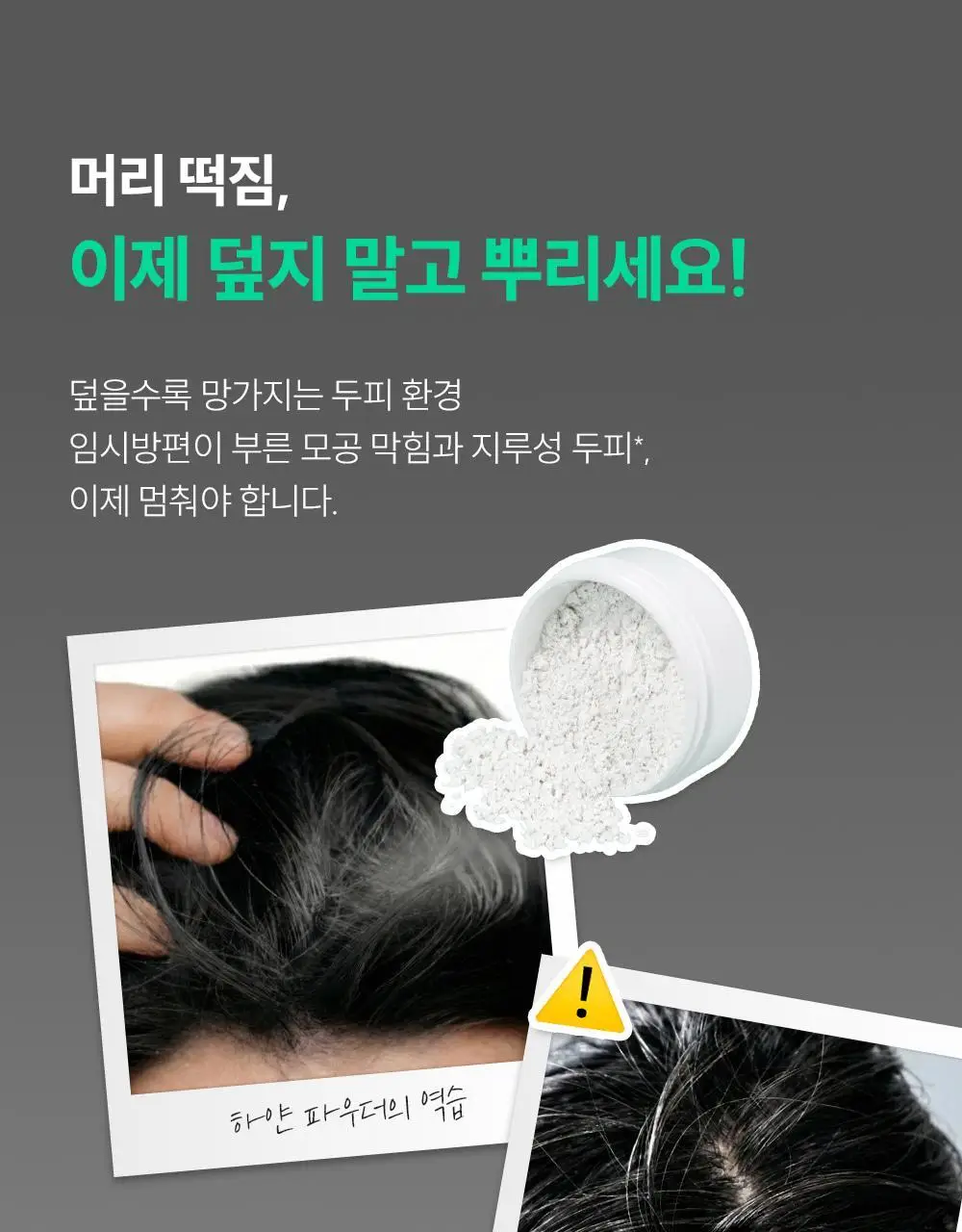 [지루성 두피케어] 낫포유 지성두피 트러블케어 미스트 80ml 기획 (+미니어처 30ml) 상세페이지 12